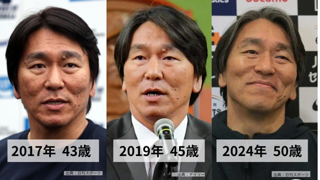 松井秀喜の白髪はいつからか比較画像