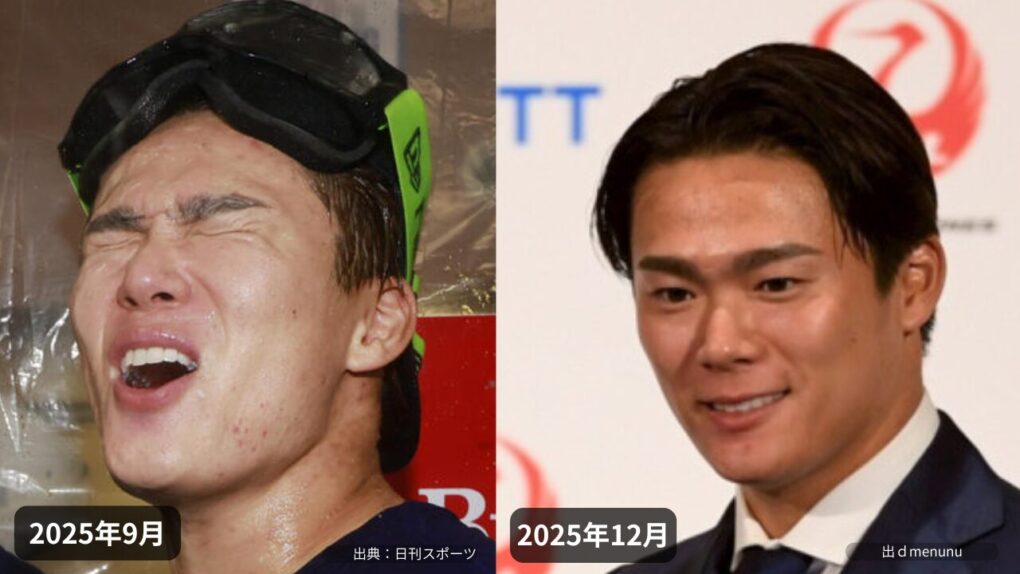 山本由伸の肌きれいになった比較画像